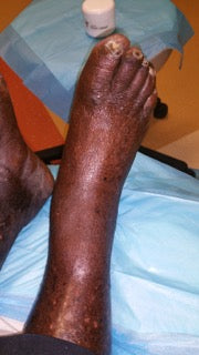 Dr. Mike's Foot Cream 4oz Jar